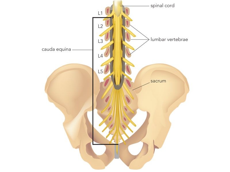 Spinal Fractures
